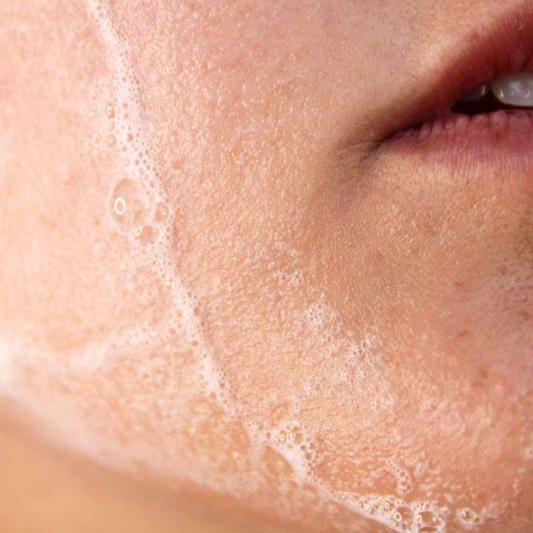 Advanced Lauric Acid Cleanser