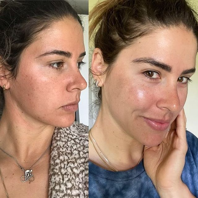 Dr. Devgan x Casa Cipriani Firming Serum